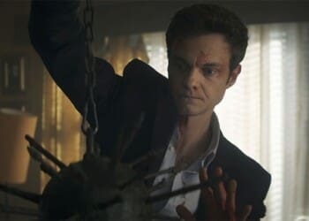 Recenze: Novokain vás rozhodně neumrtví nudou